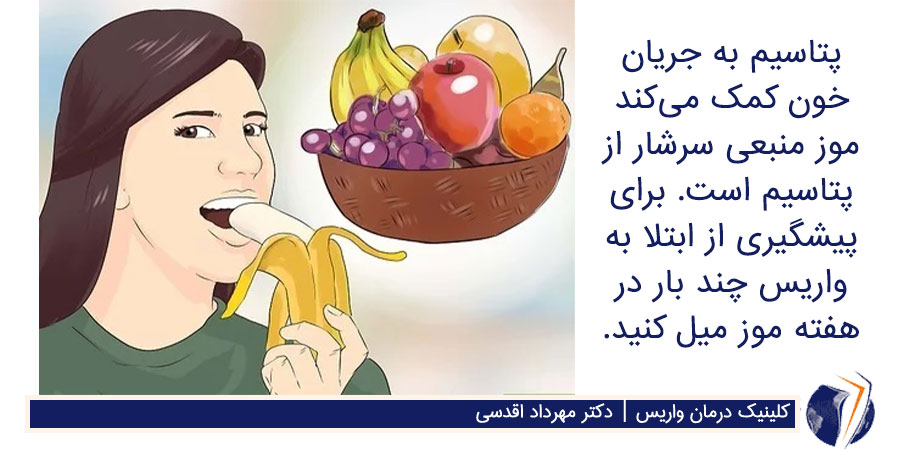 برای درمان واریس چه بخوریم