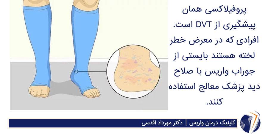 جوراب واریس برای پیشگیری از بیماری dvt