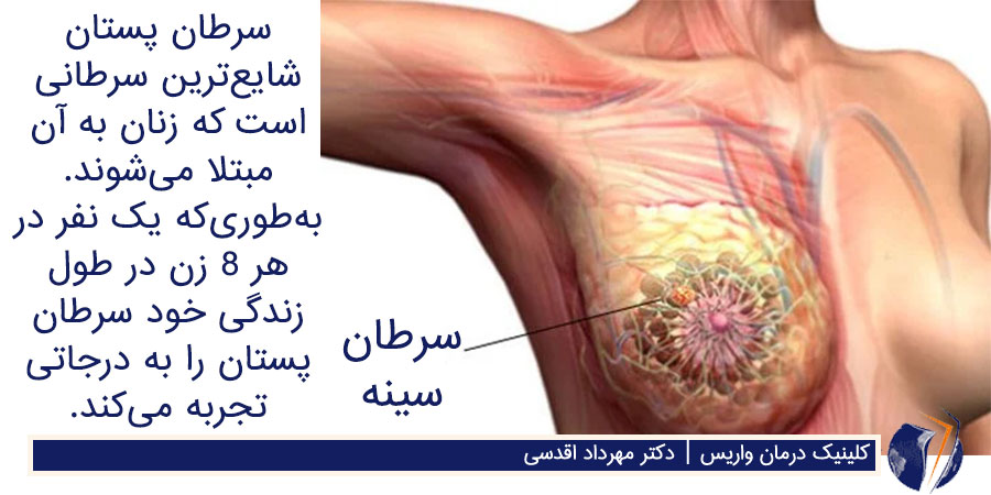 عکس سرطان سینه