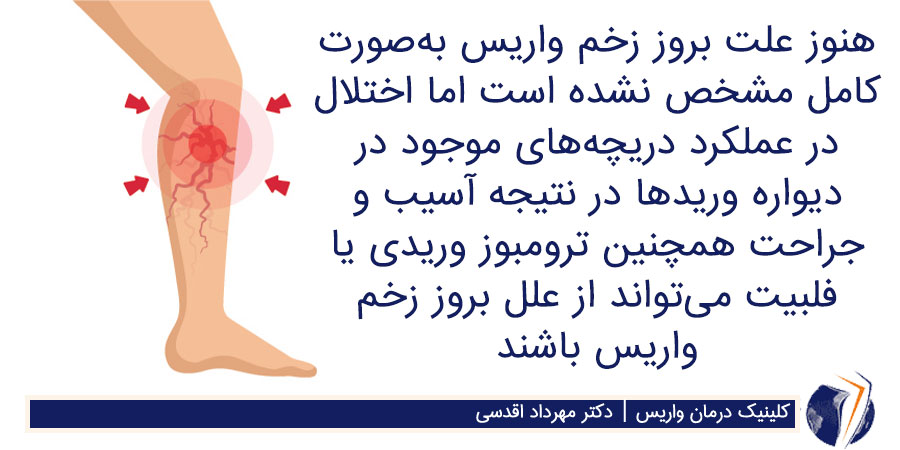 دلیل ایجاد زخم واریس