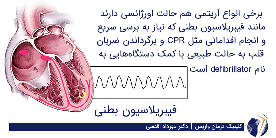 فیبریلاسیون بطنی