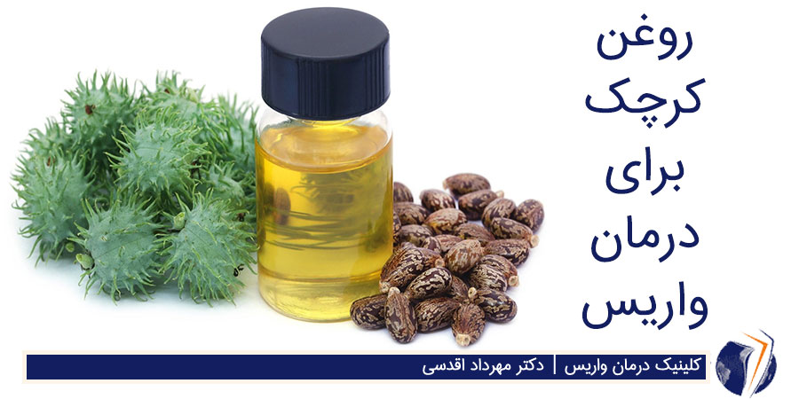 روغن کرچک برای درمان واریس