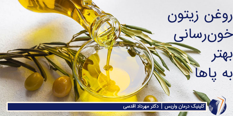 روغن زیتون برای درمان واریس