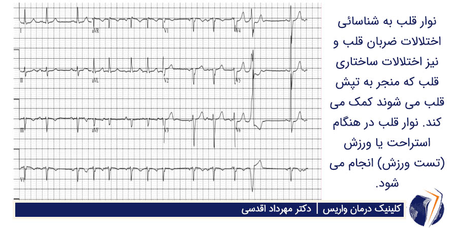 نوار قلب