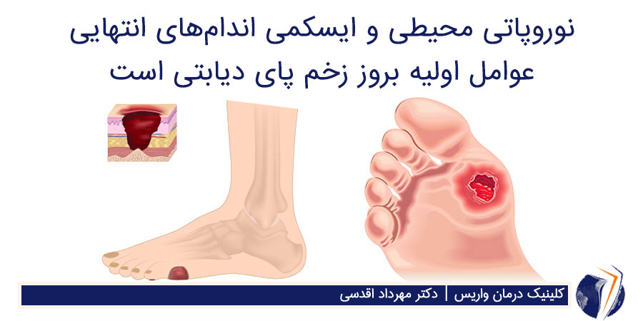 علت زخم پای دیابتی