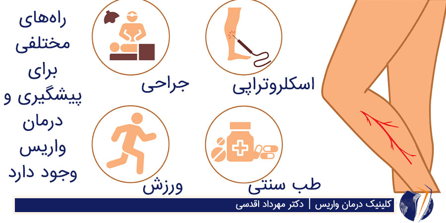 روش‌های مختلف درمان واریس