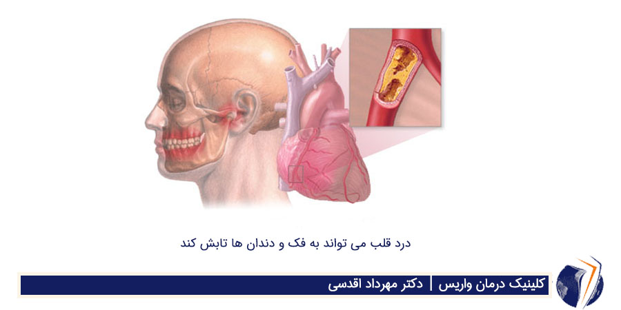 درد قلب تاثیر آن برروی فک