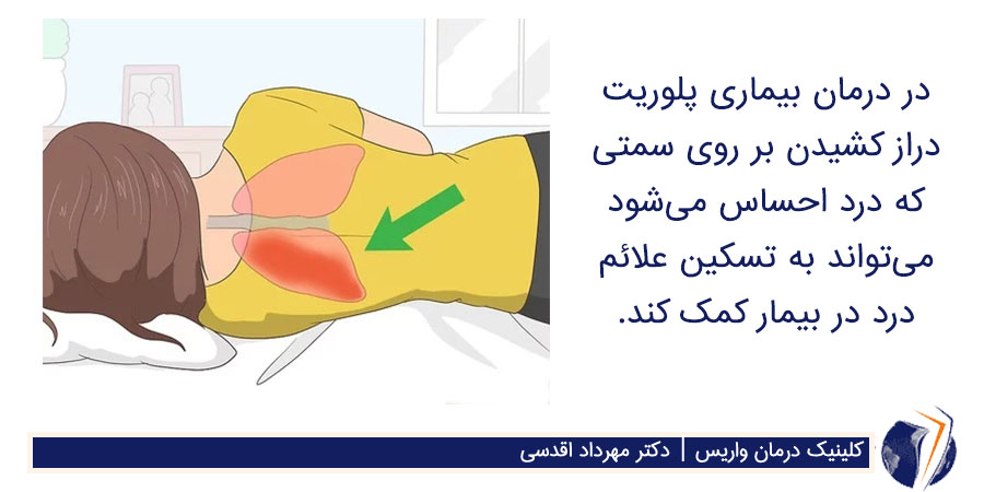 برای درمان خانگی بیماری پلوریت، بیمار به پهلو و در سمتی که احساس درد دارد دراز کشیده است