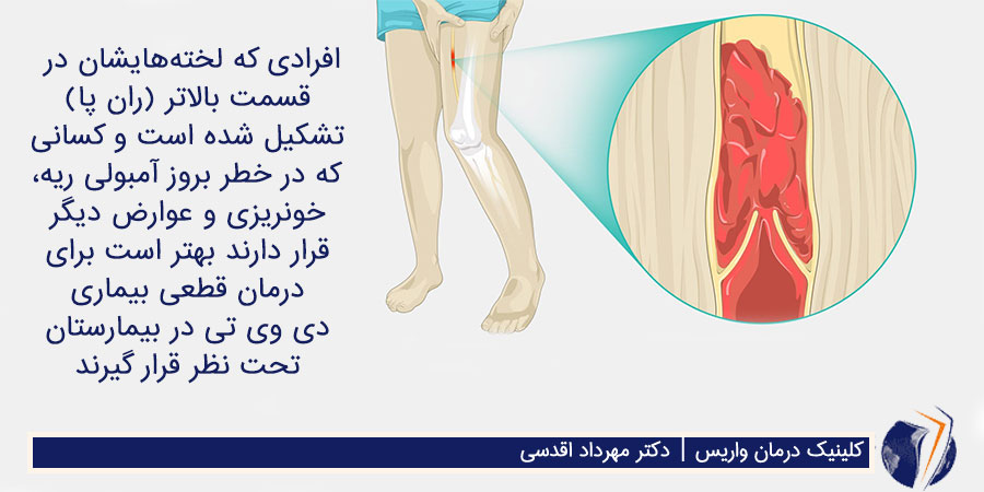 لخته خون در بالای ران پا