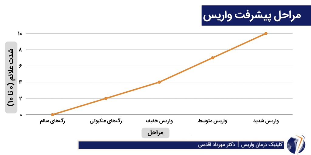 نمودار پیشرفت واریس