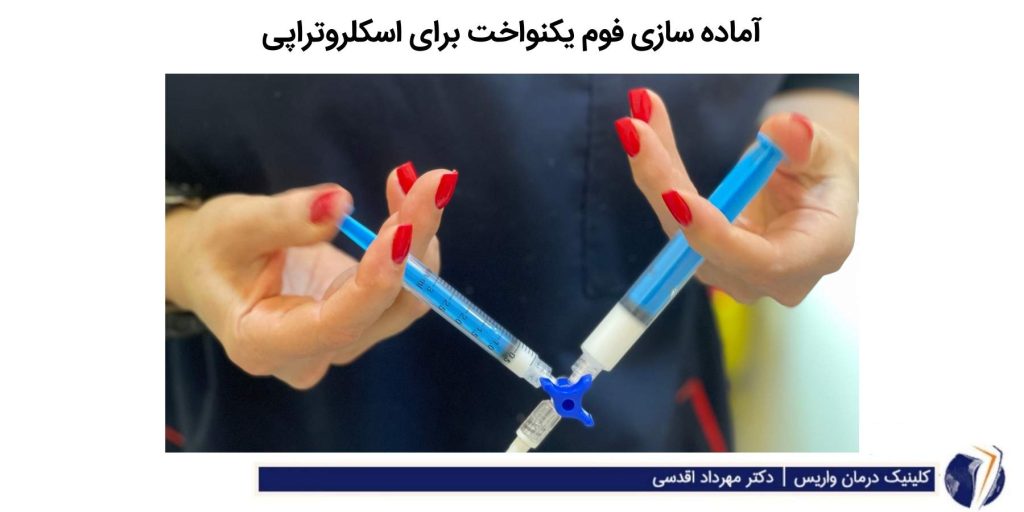 آماده سازی فوم بکنواخت برای اسکلروتراپی